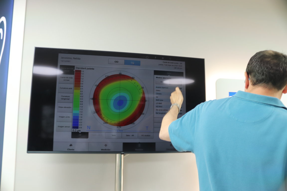 Prueba de topografía corneal en Ópticas Jerónimo
